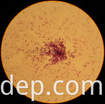 lactococcus lactis
